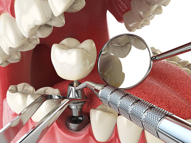 Best Holiday Emergency Dentist in Braddock Heights, MD