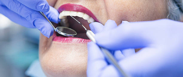 Best Emergency Dental Extractions in Braddock Heights, MD