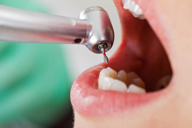 Best Pediatric Emergency Dentist in Braddock Heights, MD